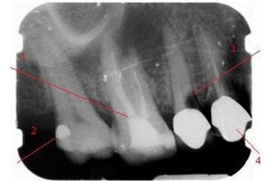 Рентгенологическая диагностика в стоматологии