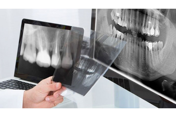 Рентгенодиагностика в стоматологии презентация