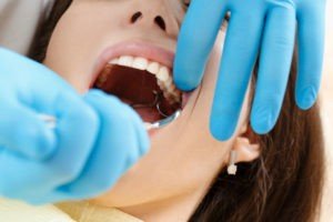 Что делать, когда удалили зуб?